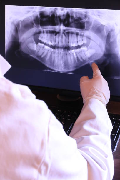Best Knocked-Out Tooth Emergency  in Cordele, GA